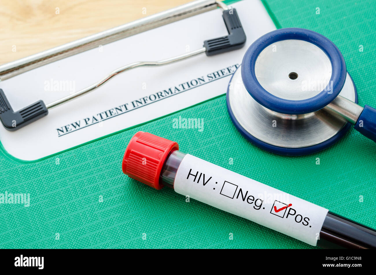 Probenröhrchen Blut mit HIV-Test-Label auf HIV-Infektion und Stethoskop mit neuen Patienten Schaublatt. Stockfoto