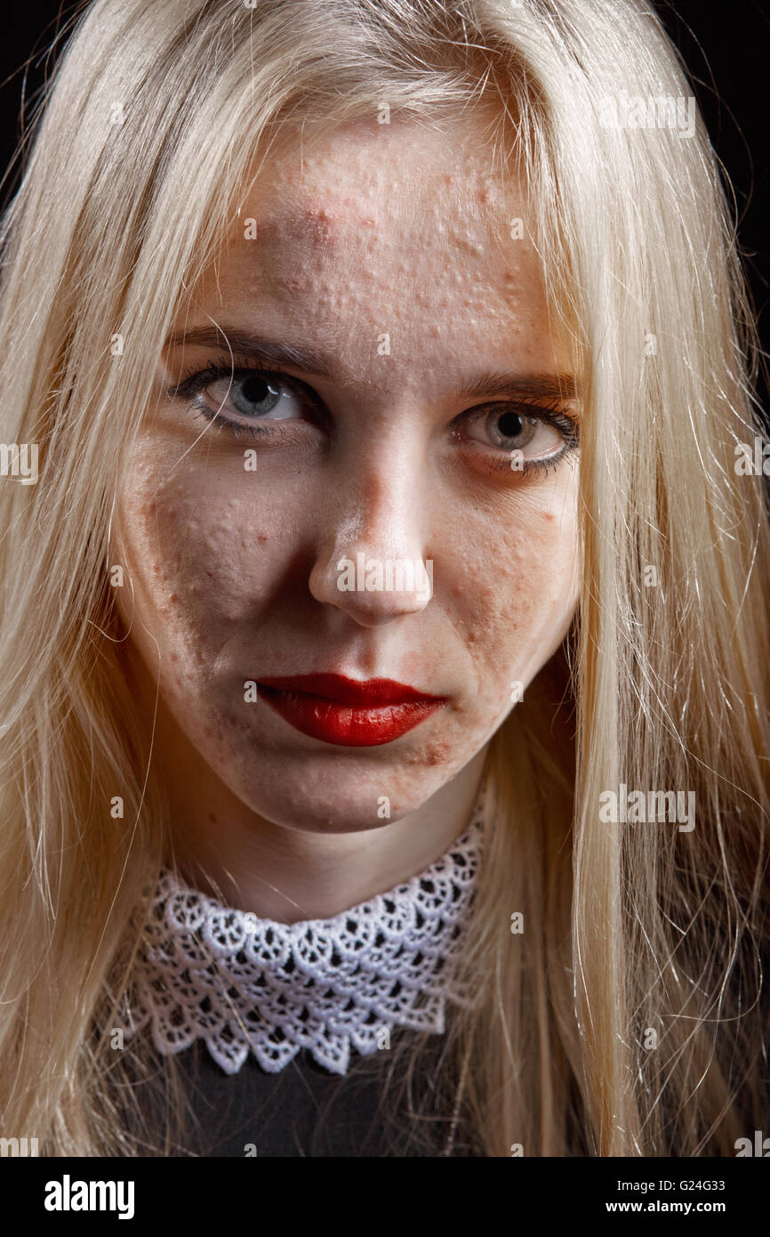 finnigen Haut blonde Mädchen auf schwarzem Hintergrund Stockfoto
