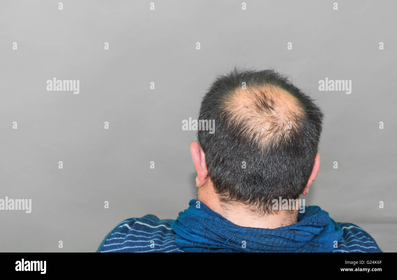 Reife Yang Mann, gesehen von hinten in den Kopf, Haare zu verlieren beginnt, beginnt er zu alt zu sein. Stockfoto