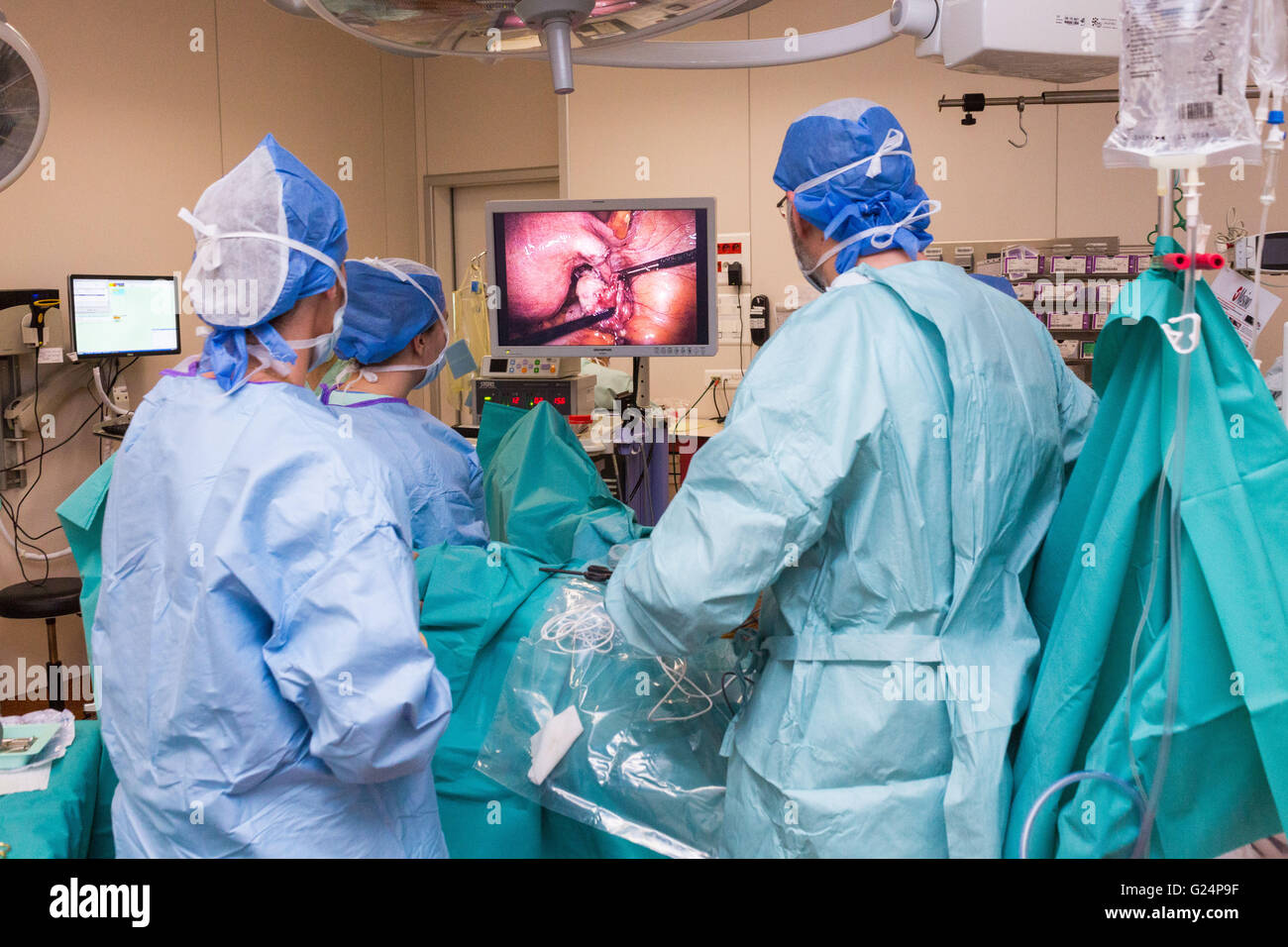 Explorative Laparoskopie und operative Hysteroskopie (Myome, Endometriose). Limoges-Krankenhaus. Stockfoto
