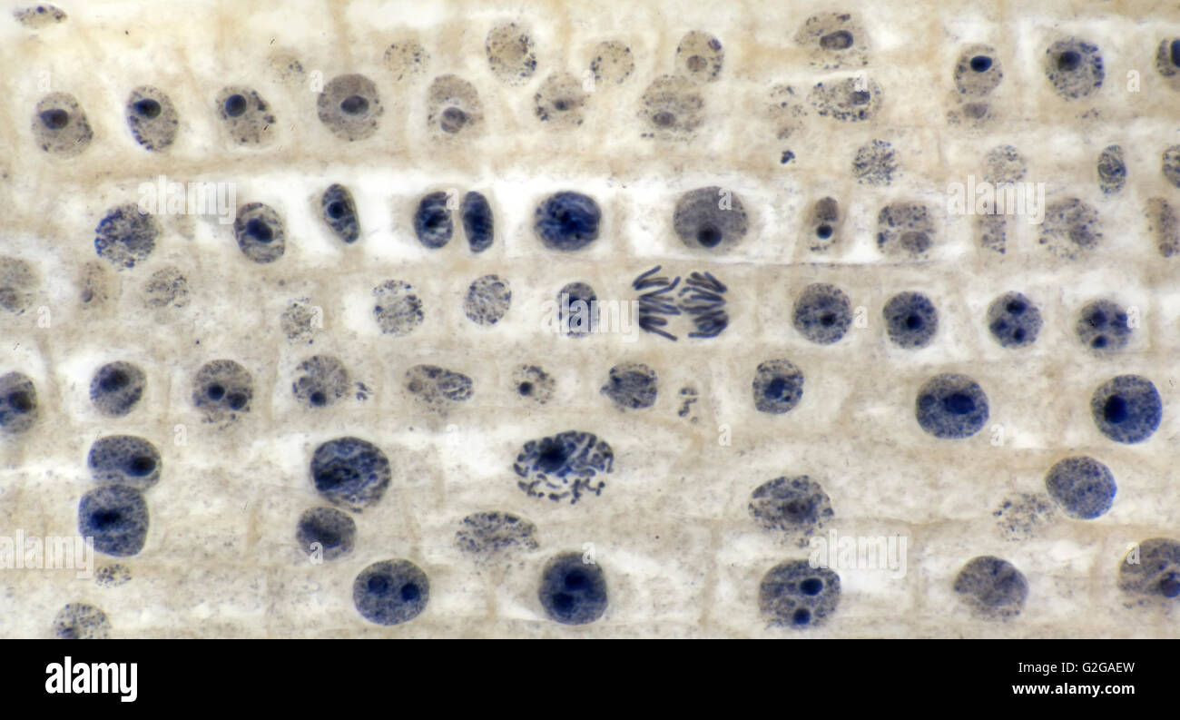 Mitose-Zellteilung in Zwiebel Wurzelspitze, Hellfeld Mikrophotographie Stockfoto
