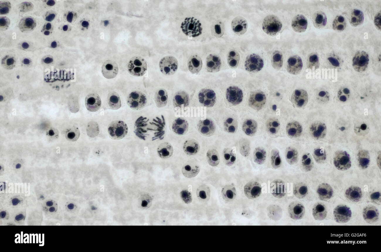 Mitose-Zellteilung in Zwiebel Wurzelspitze, Hellfeld Mikrophotographie Stockfoto