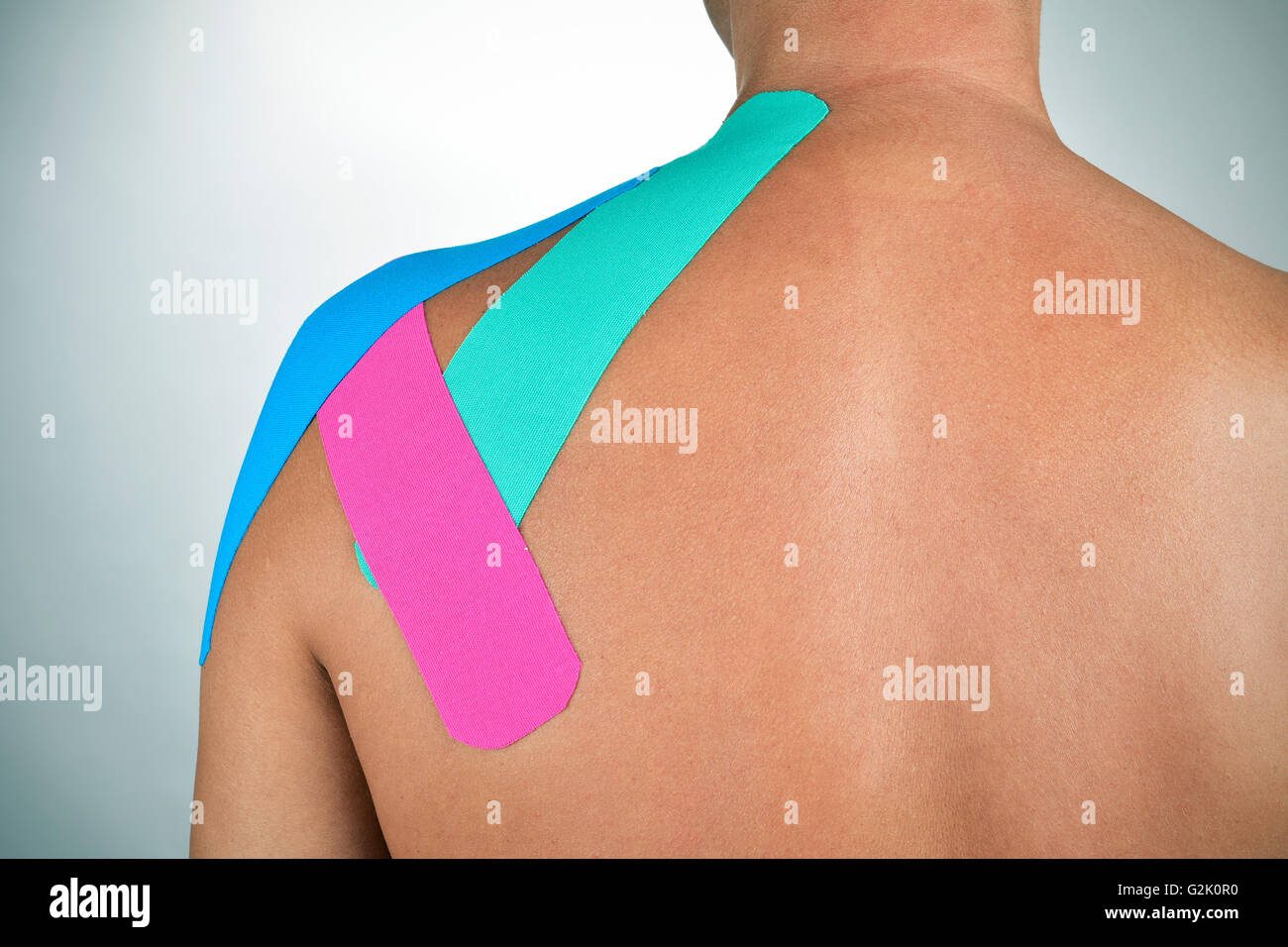 Closeup von einem kaukasischen Jüngling mit einigen Klebestreifen elastische therapeutische verschiedener Farben in den Rücken Stockfoto
