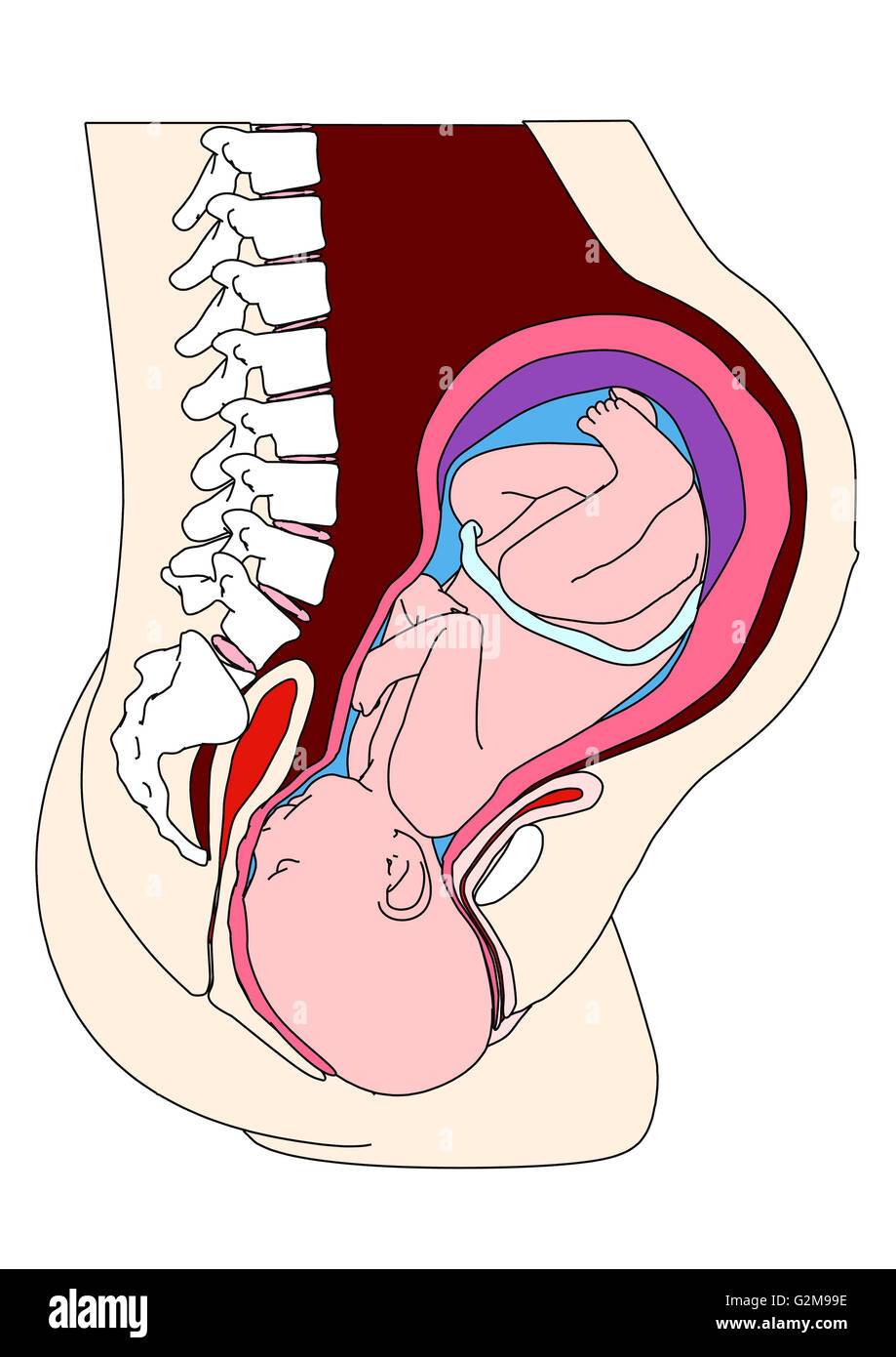 Querschnitt der Gebärmutter mit Fötus vertrieben Stockfoto