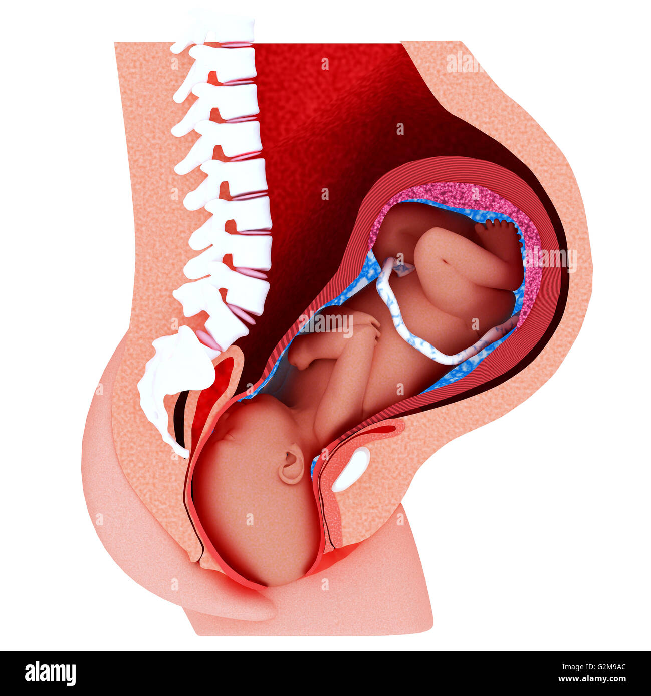 Querschnitt der Gebärmutter mit Fötus vertrieben Stockfoto