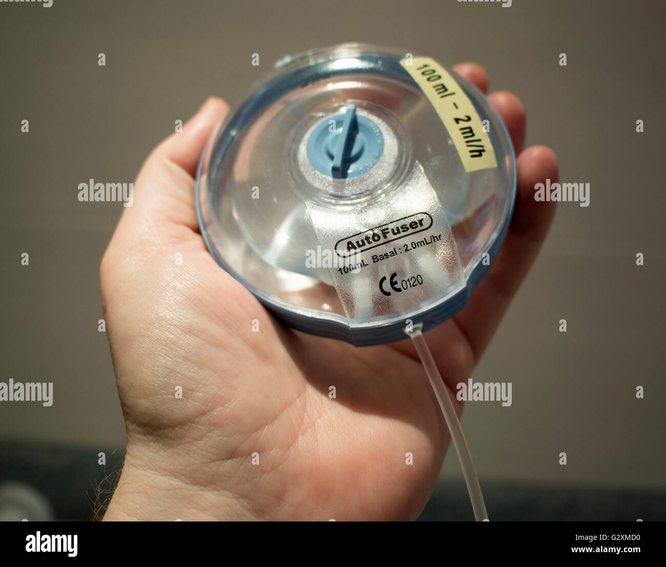 Eine automatische Fixierstation Chemotherapie Pumpe. Stockfoto