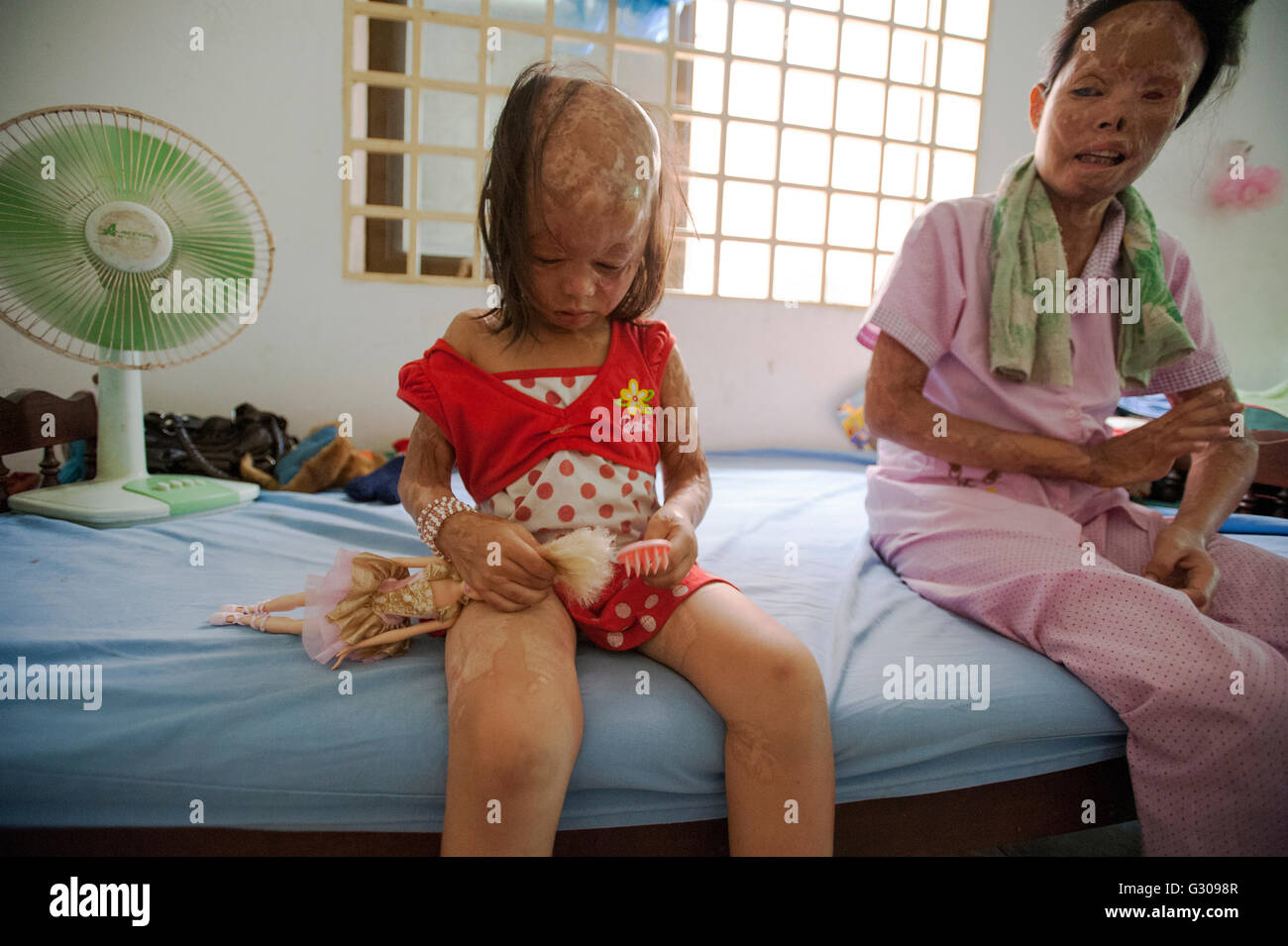 Kambodschanische sauren Gewalt Überlebenden Chheav Chenda und ihre Tochter Bun Cheata im kambodschanischen Säure Überlebenden Charity (CASC). Stockfoto