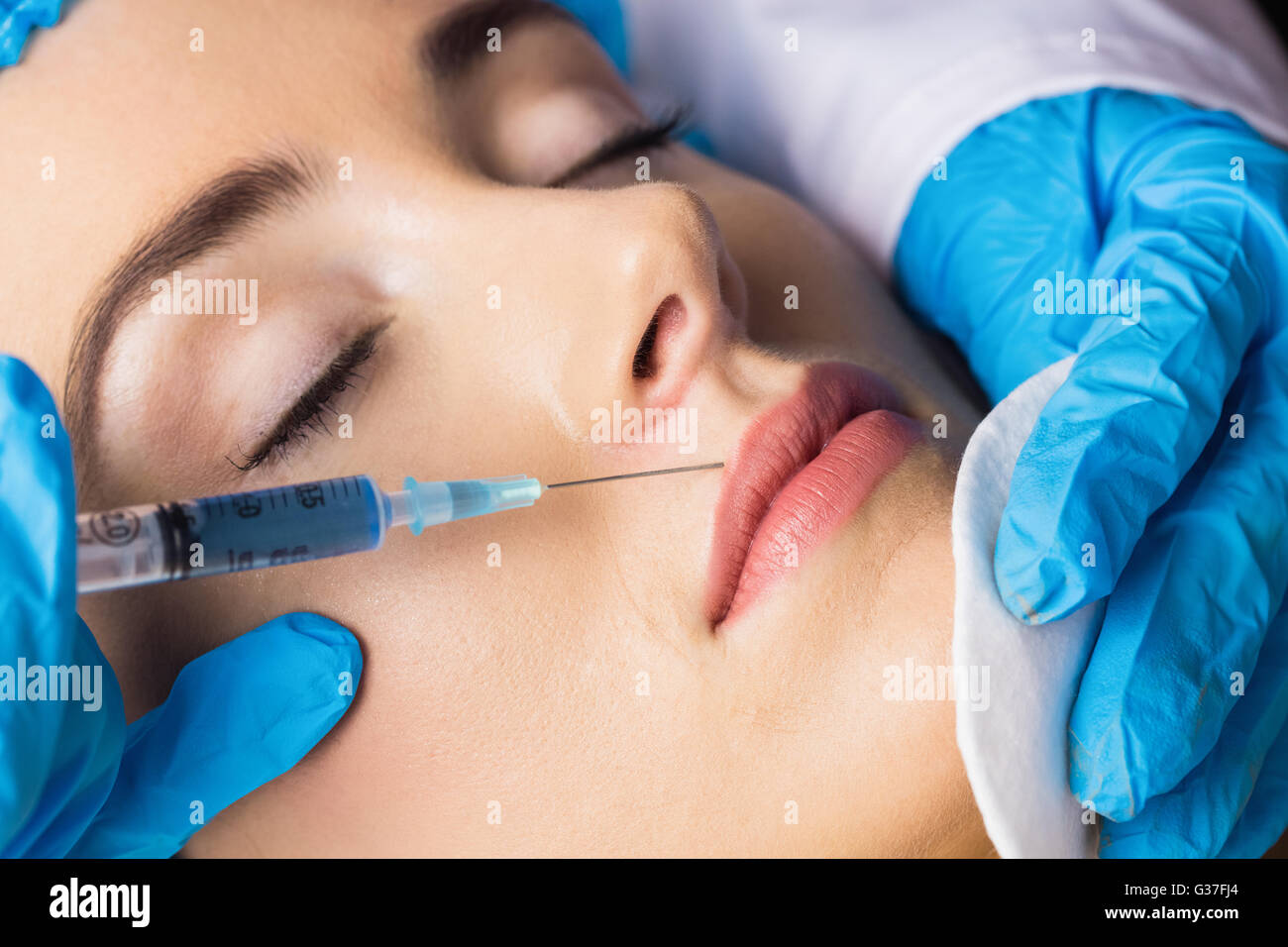 Frau empfangen Botox-Injektion auf den Lippen Stockfoto