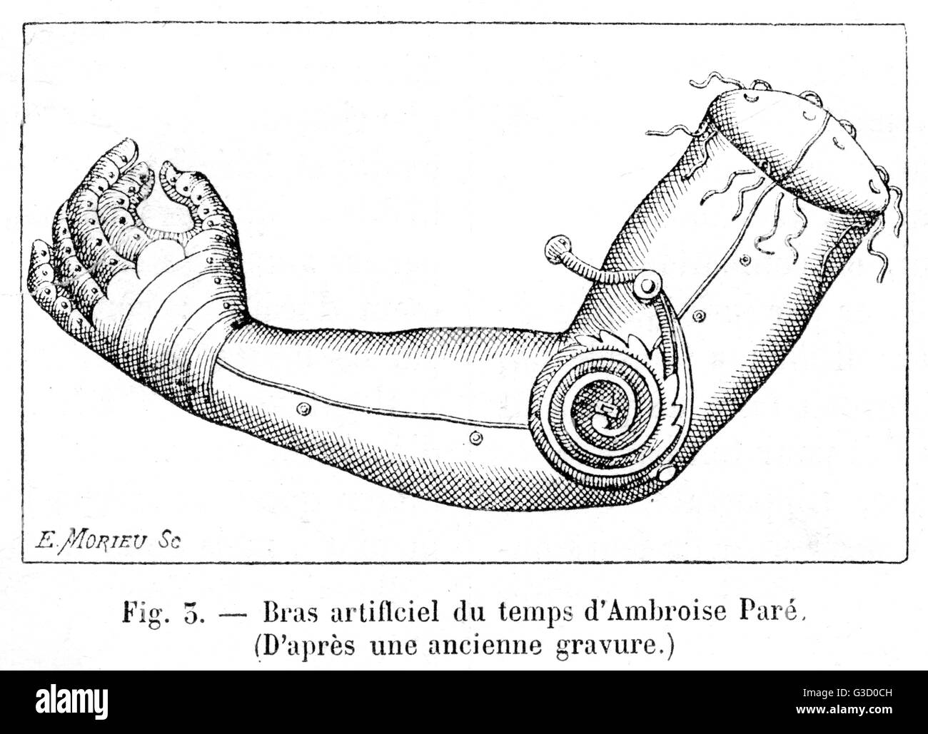 Der künstliche Arm von Ambroise ParÚ Stockfoto