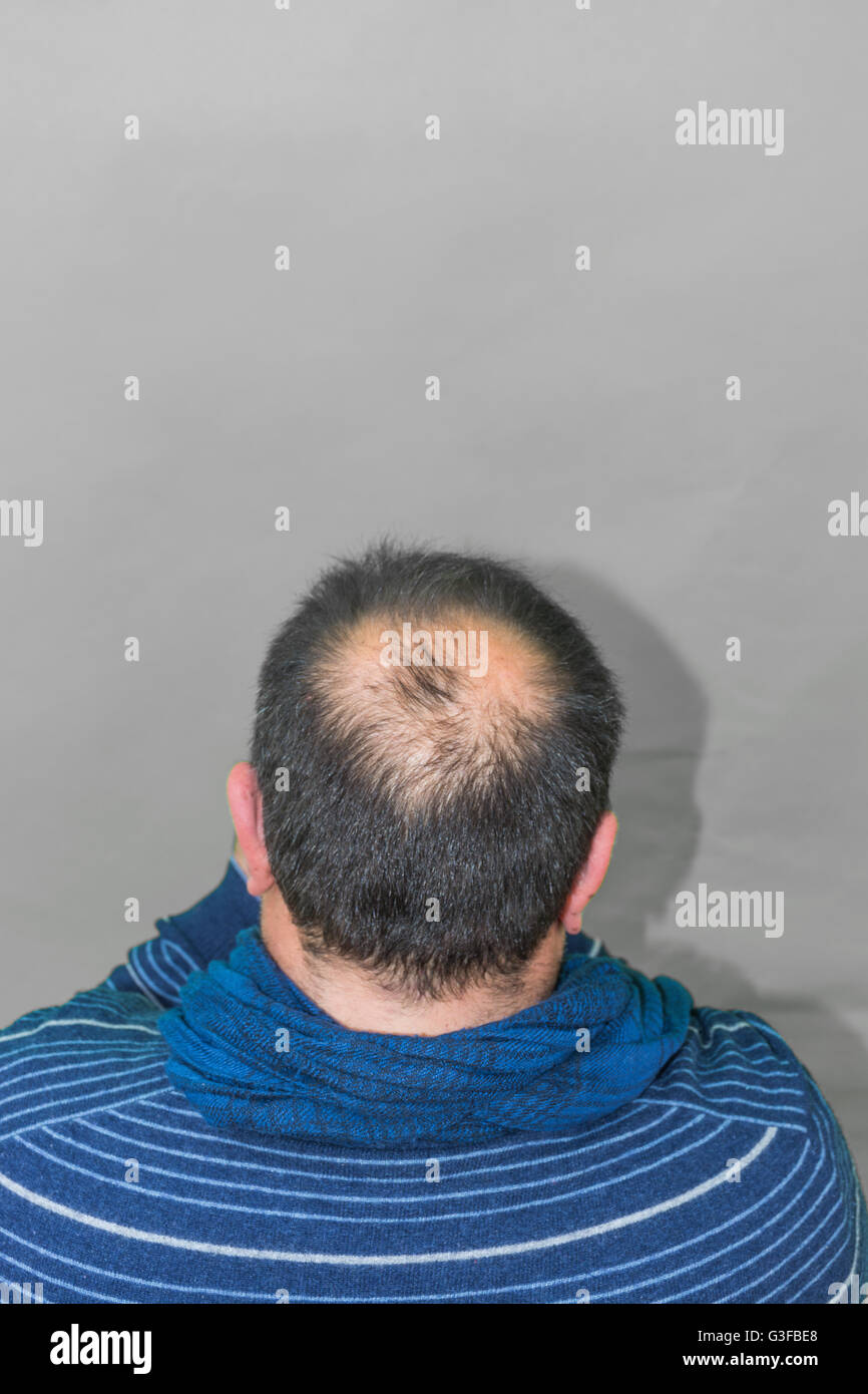 Reife Yang Mann, gesehen von hinten in den Kopf, Haare zu verlieren beginnt, beginnt er zu alt zu sein. Stockfoto