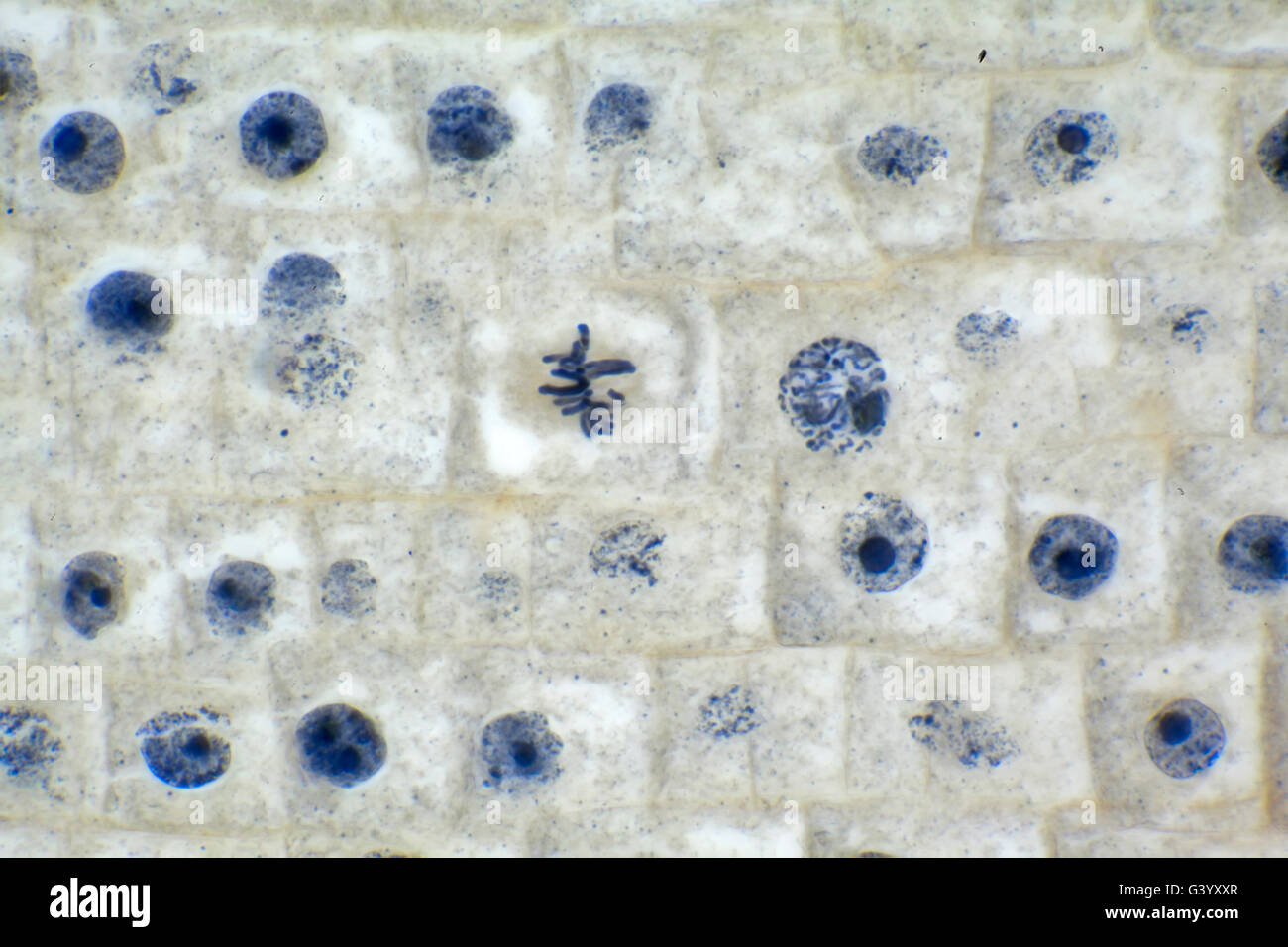 Hellfeld Mikrophotographie, Zwiebel Wurzelspitze, zeigt Zellteilung Stockfoto