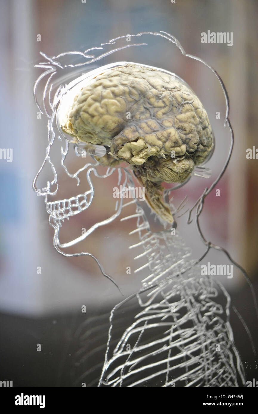 Ein echtes menschliches Gehirn in Flüssigkeit mit einem maßstabsgefertigten Skelett, zentralem Nervensystem und menschlicher Silhouette in Acryl gehauen, in der @Bristol Science Attraction als Teil der neuen Ausstellung "All About US", die am Freitag, 11. März, für die Öffentlichkeit geöffnet wird. Stockfoto
