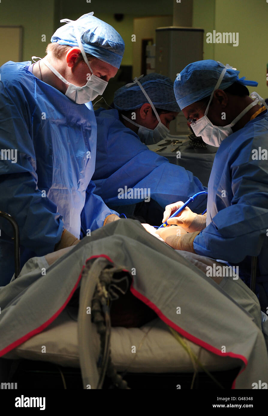 Ein generisches Stockfoto einer Operation, die im Queen Elizabeth Hospaital, Birmingham, stattfindet. Stockfoto