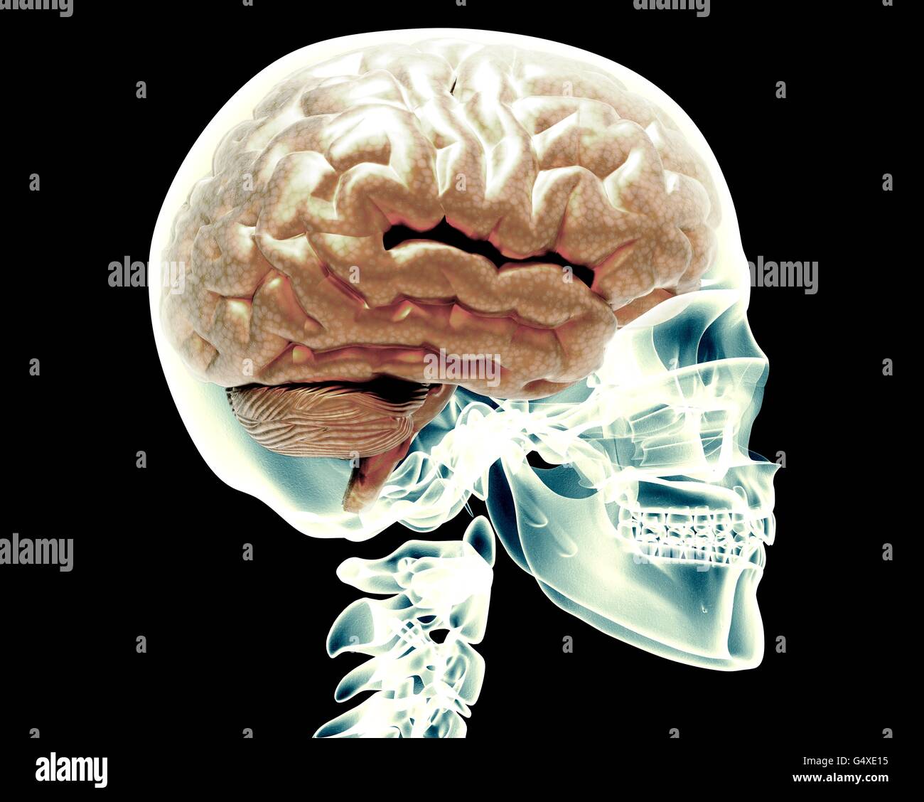 Röntgen-Schädel mit Gehirn isoliert auf schwarz Stockfoto
