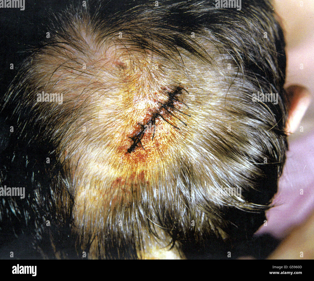 Nachbesserungsversuch Breakout Verletzungen Stockfoto