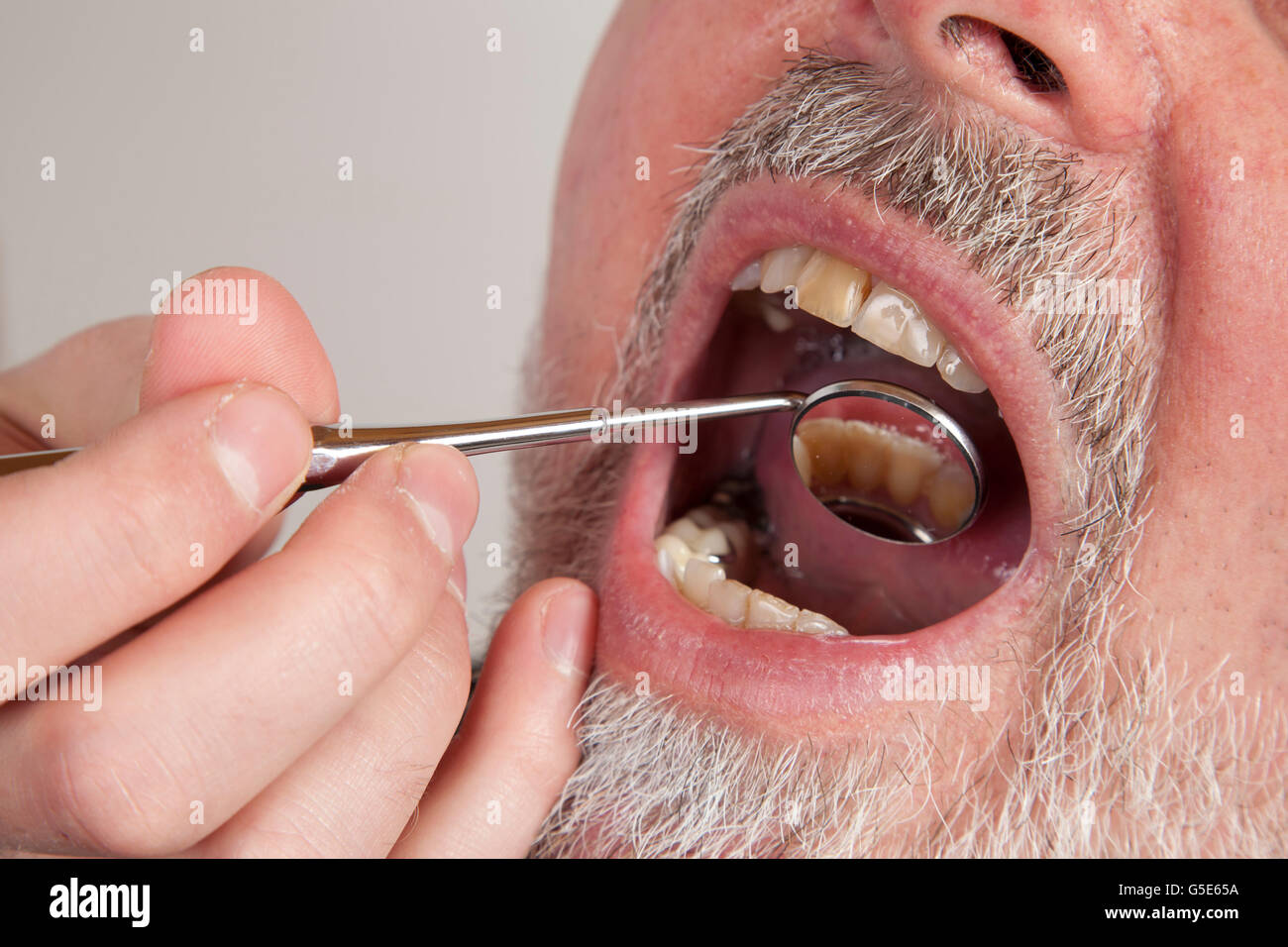 Patient, 59, während eine Kontrolluntersuchung beim Zahnarzt Stockfoto
