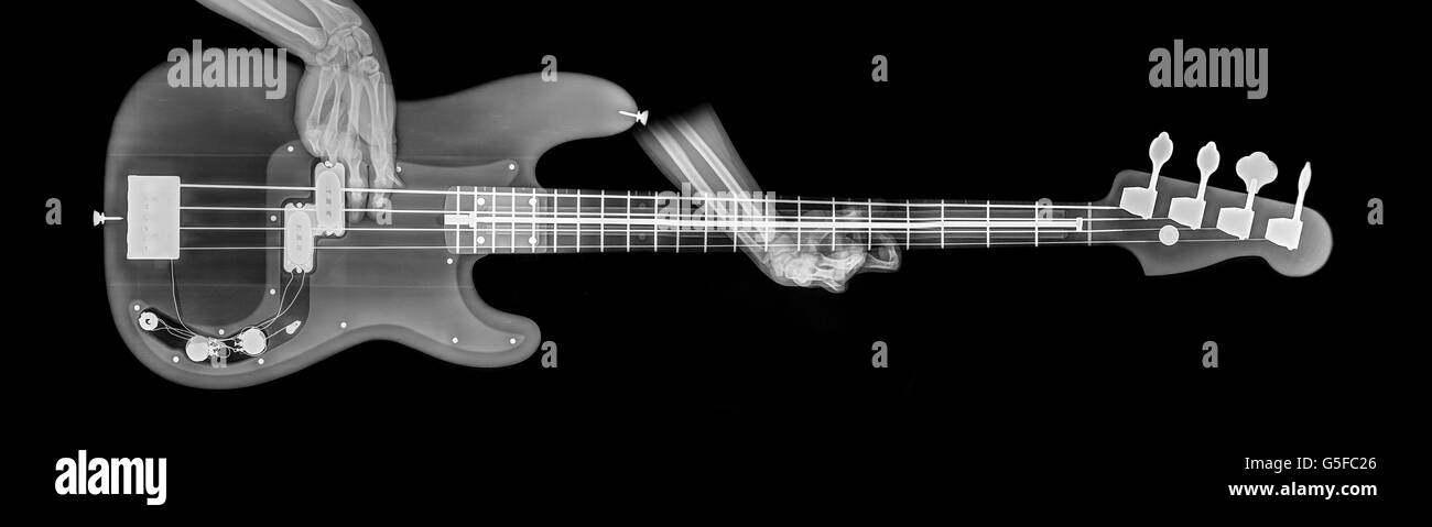 Hände spielen Basis Gitarre unter Röntgenkontrolle Stockfoto
