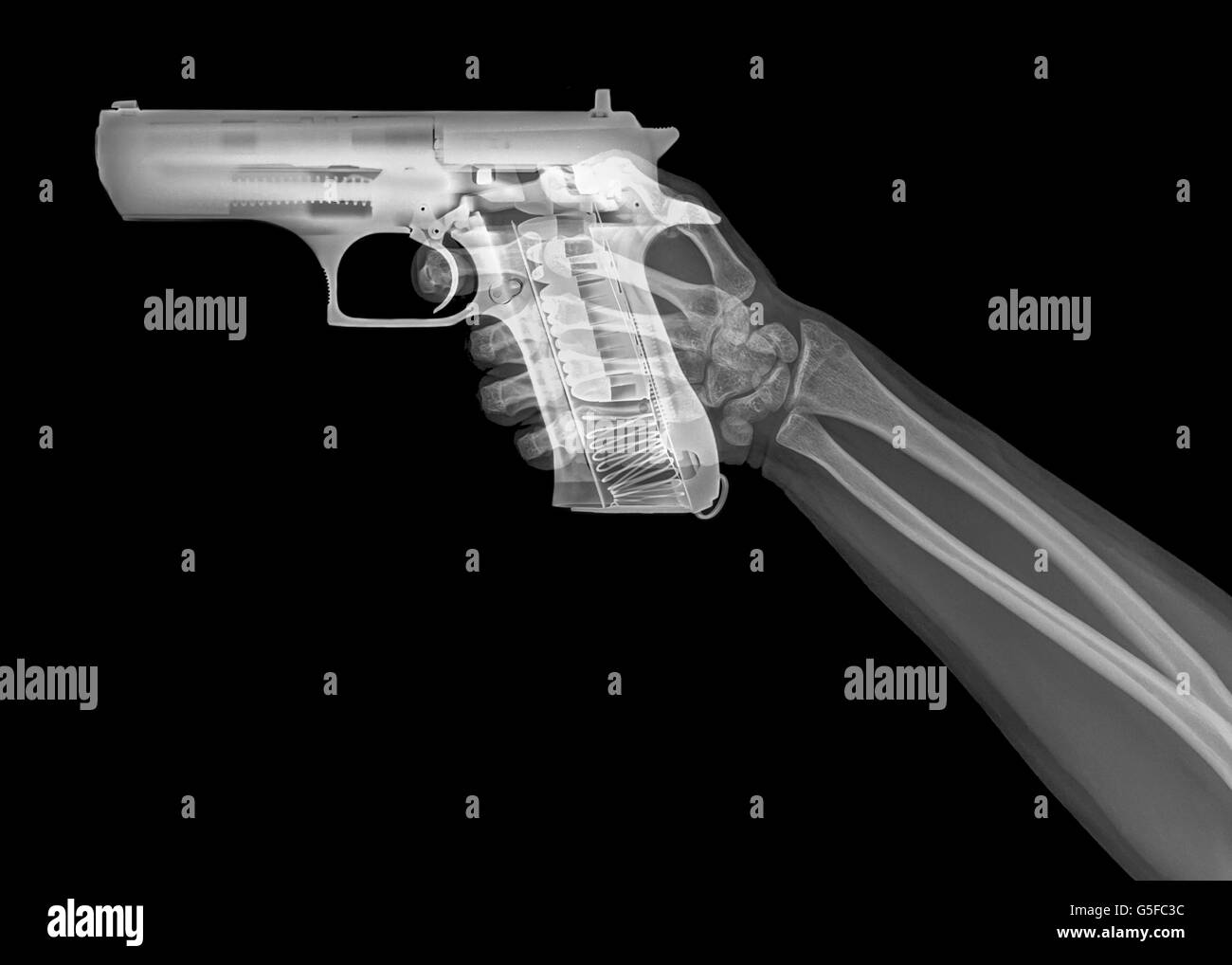 Hand hält eine Pistole unter Röntgenkontrolle Stockfoto