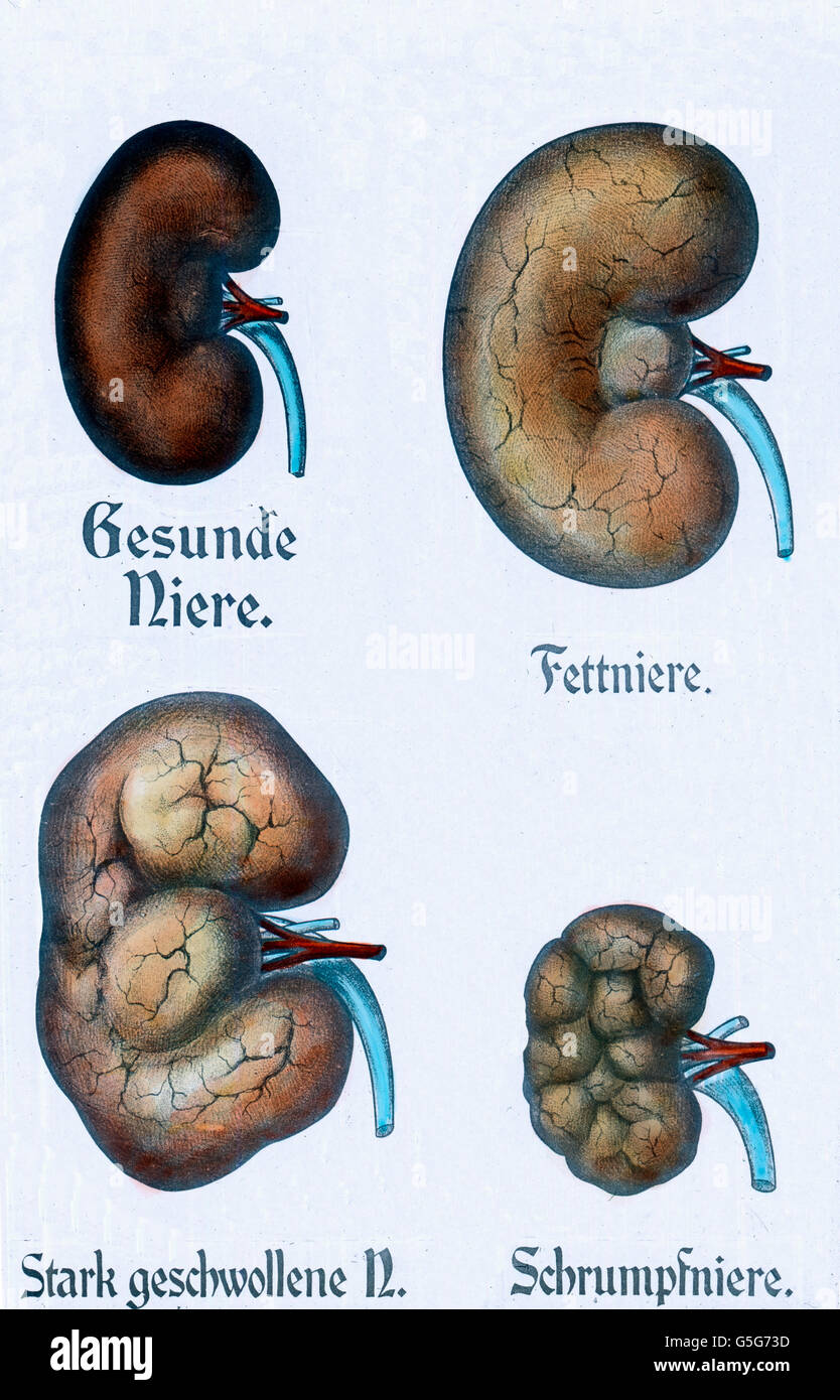 Gesundheitszustand sind Nieren. Gesundheitszustand der vier Nieren. gut