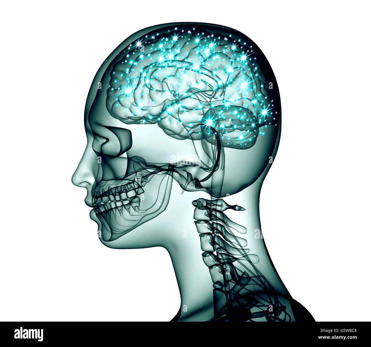 Röntgenbild der menschliche Kopf mit Gehirn und elektrische Impulse, 3d illustration Stockfoto