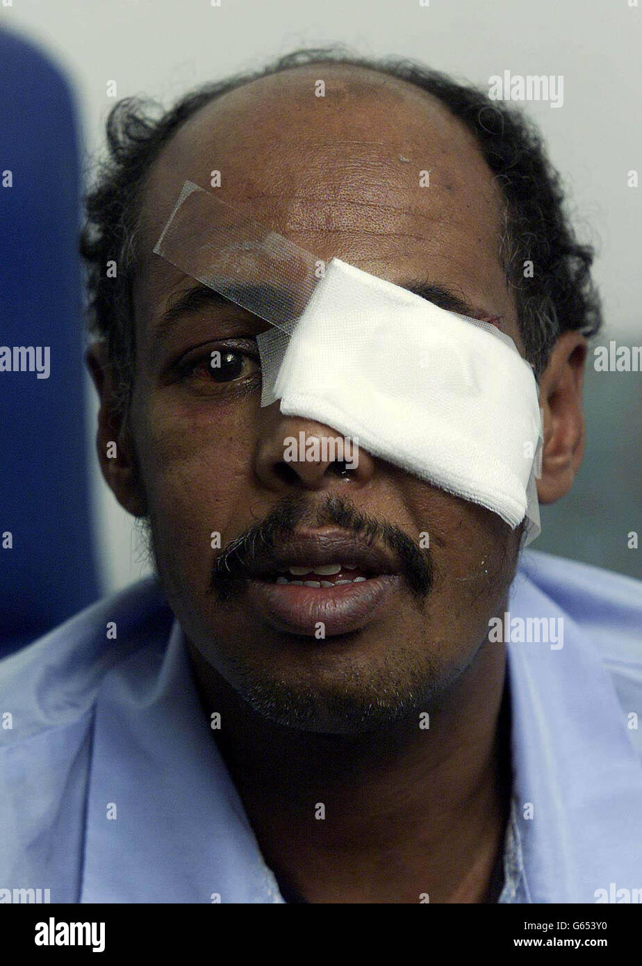 Ahmed Ali aus Somalia, der bei einem rassistischen Angriff von vier Männern in Hackney halb verblindet wurde und sagte, dass seine Angreifer durch Hass motiviert seien. * Herr Ali wurde am Samstag bei dem Vorfall rassistisch missbraucht, geschlagen und zu Boden getreten und mit einer Metallstange oder einem Pfosten geschlagen. Stockfoto