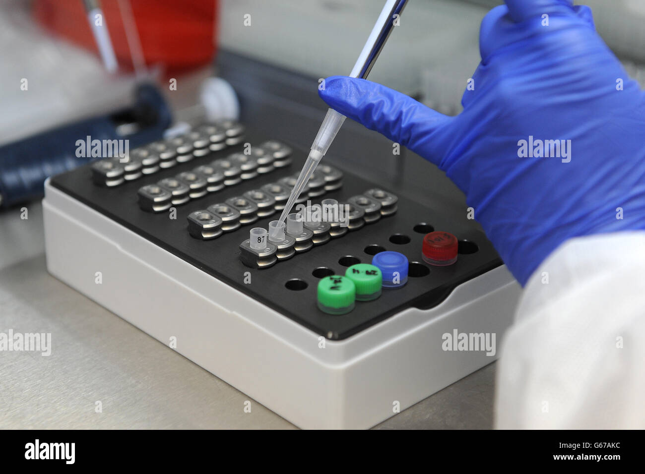 Allgemeine Ansicht der Ausrüstung, die in der Analyse des Blutes verwendet wird, um die Wahrscheinlichkeit einer schwangeren Frau zu bestimmen, die postnatale Depression entwickelt. Forschungen unter der Leitung von Professor Dimitris Grammatopolous, Professor für Molekulare Medizin und Berater für klinische Biochemie und molekulare Diagnostik an den Universitätskliniken Coventry und Warwickshire haben gezeigt, dass eine genetische Variation dazu führen kann, dass Frauen bis zu fünfmal häufiger an postnataler Depression leiden. Stockfoto