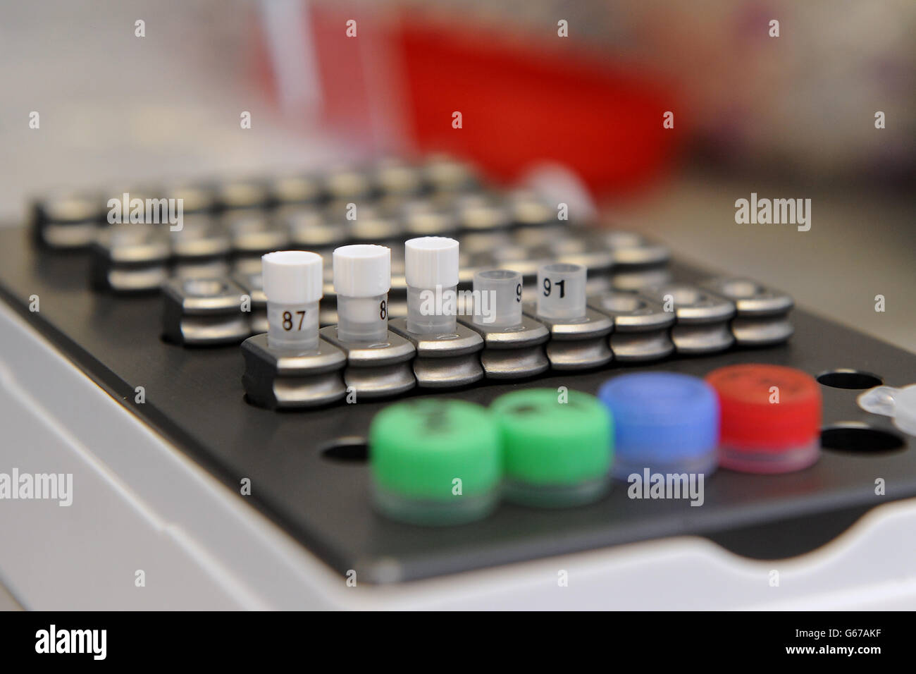 Allgemeine Ansicht der Ausrüstung, die in der Analyse des Blutes verwendet wird, um die Wahrscheinlichkeit einer schwangeren Frau zu bestimmen, die postnatale Depression entwickelt. Forschungen unter der Leitung von Professor Dimitris Grammatopolous, Professor für Molekulare Medizin und Berater für klinische Biochemie und molekulare Diagnostik an den Universitätskliniken Coventry und Warwickshire haben gezeigt, dass eine genetische Variation dazu führen kann, dass Frauen bis zu fünfmal häufiger an postnataler Depression leiden. Stockfoto