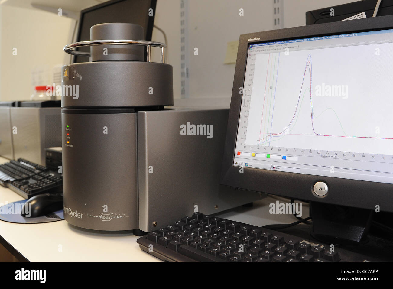 Allgemeine Ansicht der Ausrüstung, die in der Analyse des Blutes verwendet wird, um die Wahrscheinlichkeit einer schwangeren Frau zu bestimmen, die postnatale Depression entwickelt. Forschungen unter der Leitung von Professor Dimitris Grammatopolous, Professor für Molekulare Medizin und Berater für klinische Biochemie und molekulare Diagnostik an den Universitätskliniken Coventry und Warwickshire haben gezeigt, dass eine genetische Variation dazu führen kann, dass Frauen bis zu fünfmal häufiger an postnataler Depression leiden. Stockfoto
