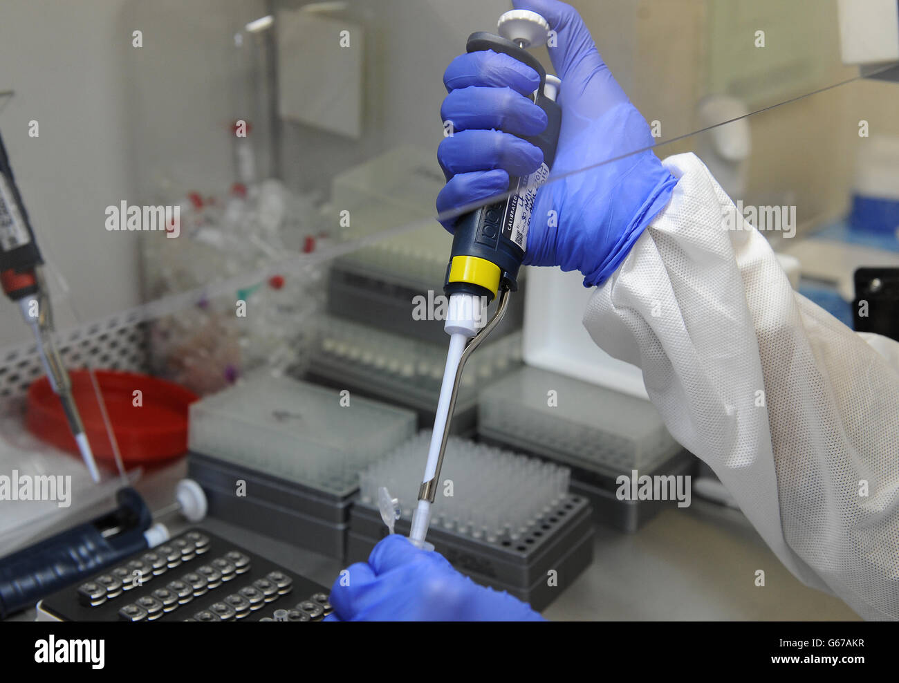 Postnatale Depression Studien Stockfoto