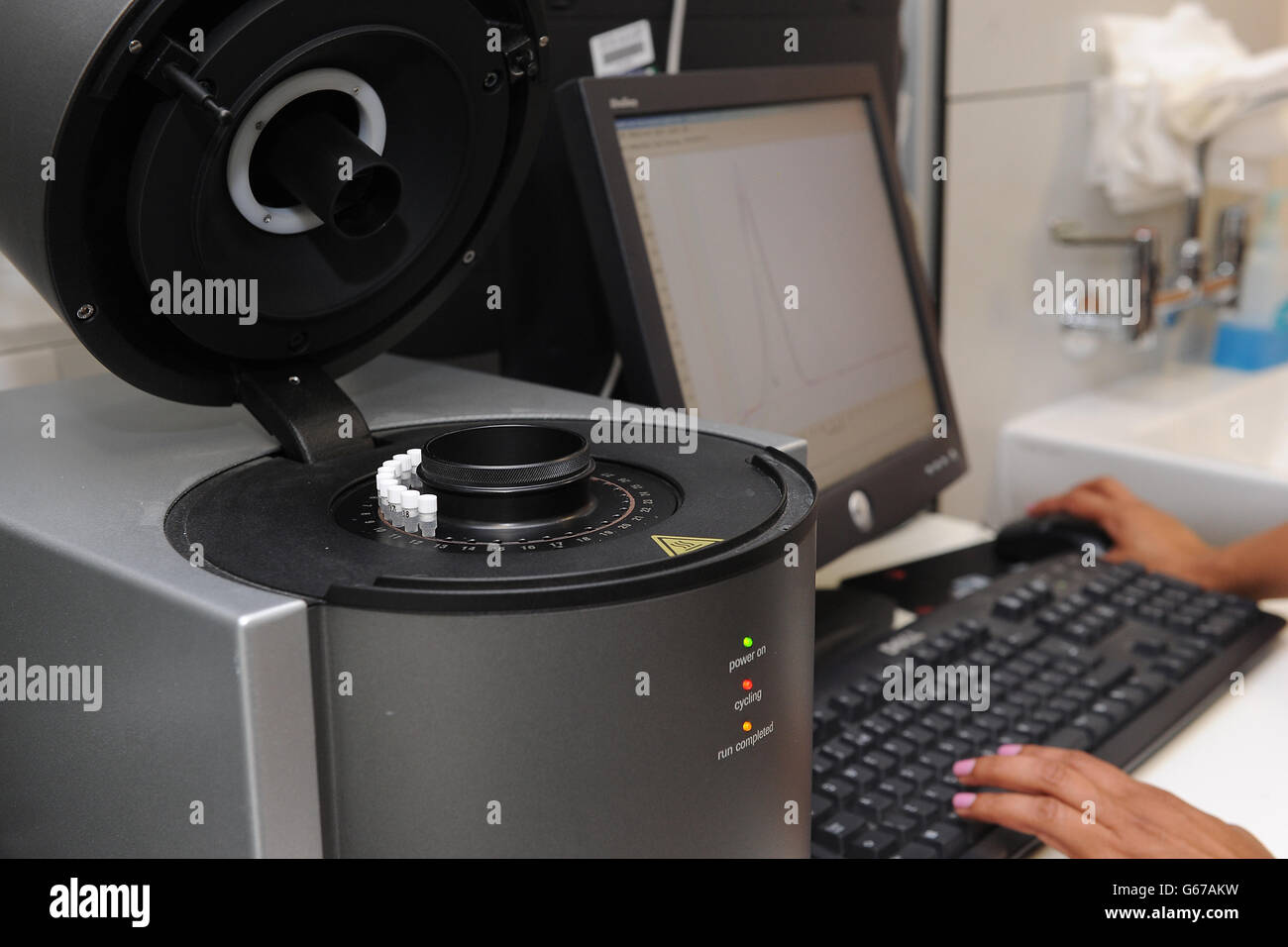 Postnatale Depression Studien Stockfoto