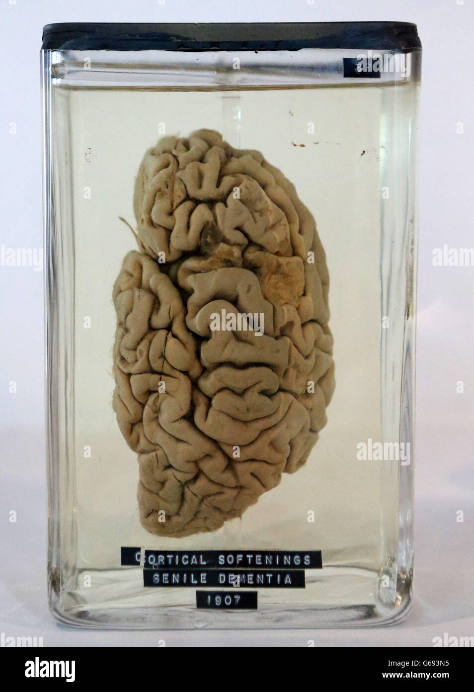 Ein zerteiltes Gehirn in einem Glas im Museum of Science and Industry (MOSI) in Manchester, Teil einer neuen Ausstellung mit dem Titel Brains: The Mind as Matter im MOSI. Stockfoto