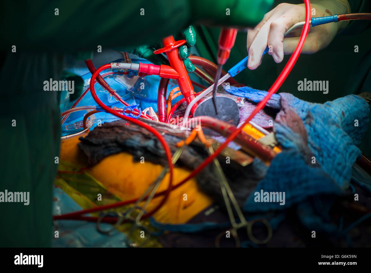 Herzoperation Stockfoto