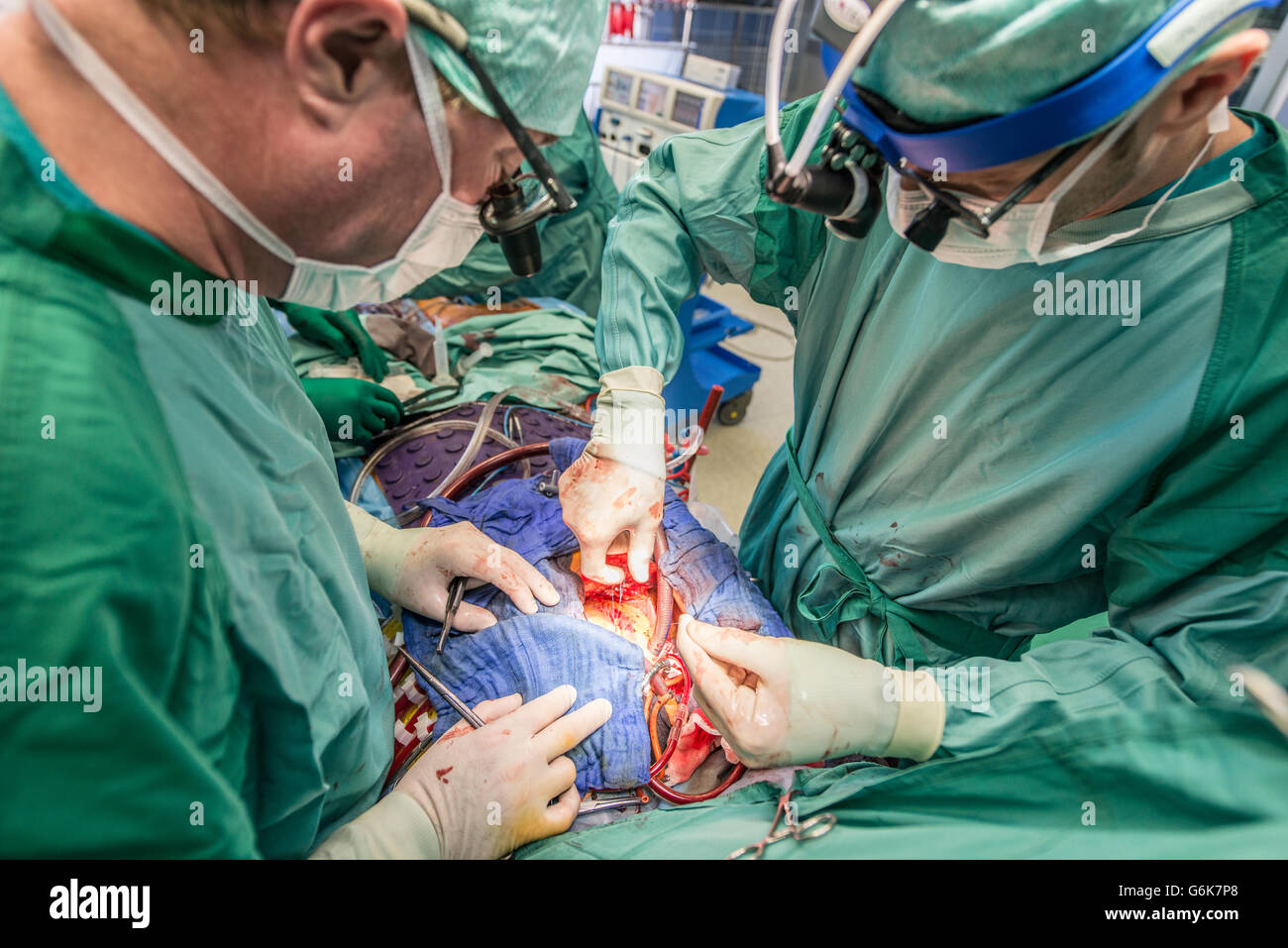 Chirurgen, die Ausführung von Herz-bypass-Operation Stockfoto