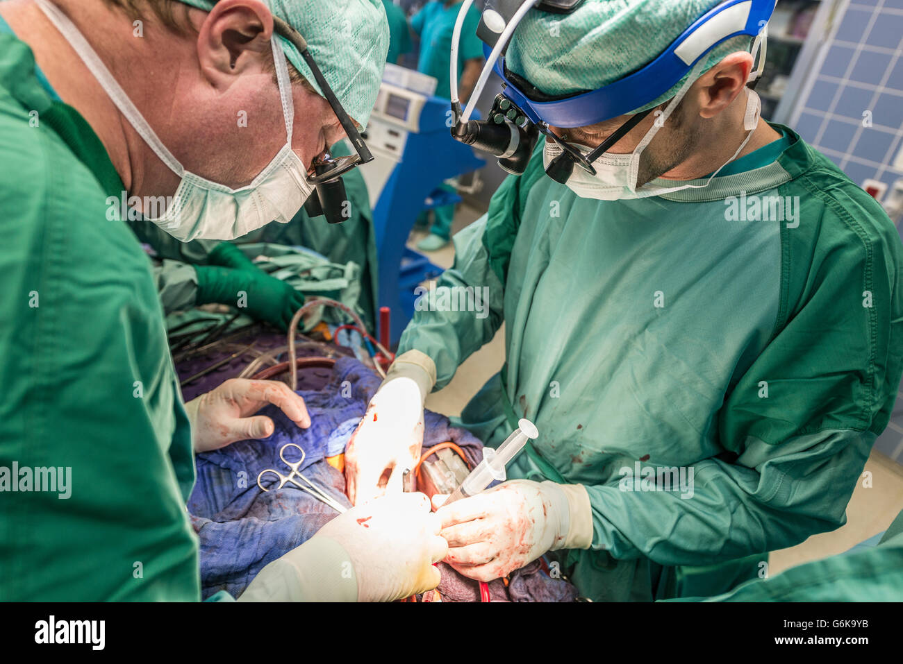 Chirurgen, die Ausführung von Herz-bypass-Operation Stockfoto