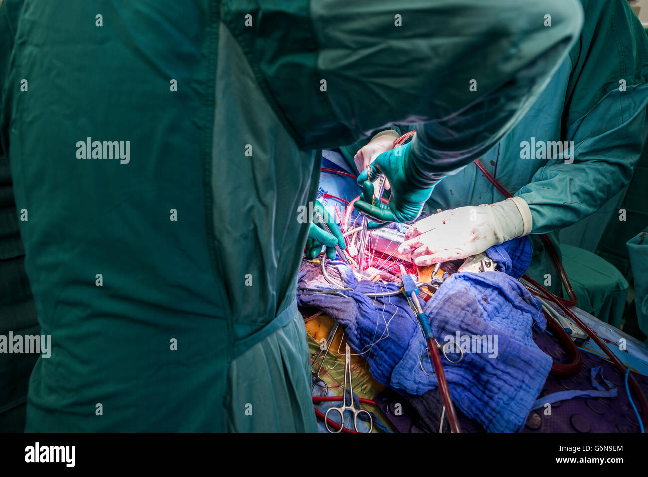 Herzchirurgen während einer Herzoperation Stockfoto
