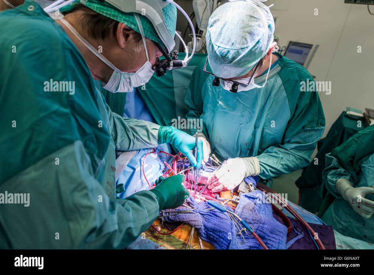Herzchirurgen während einer Herzoperation Stockfoto