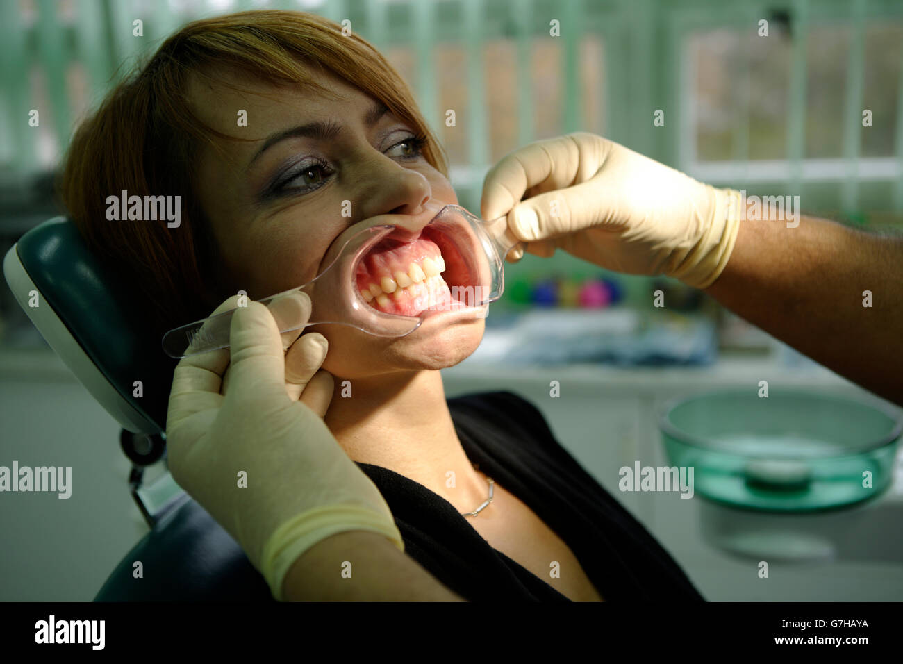 Frau, 39 Jahre, zahnärztliche Untersuchung, zahnärztliche Chirurgie Stockfoto