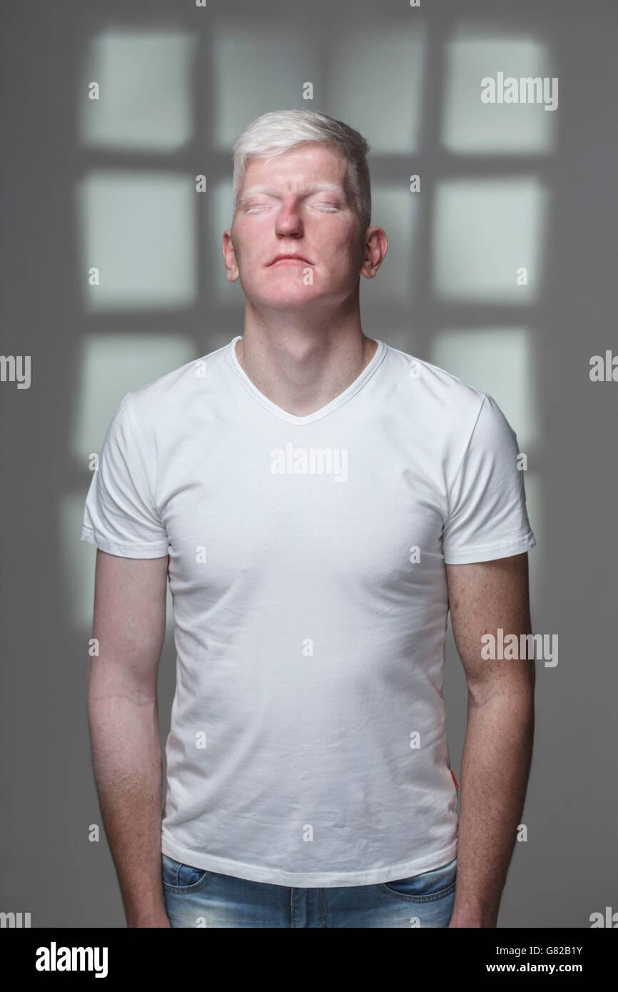 Albino-Mann mit geschlossenen Augen vor grauen Hintergrund stehend Stockfoto
