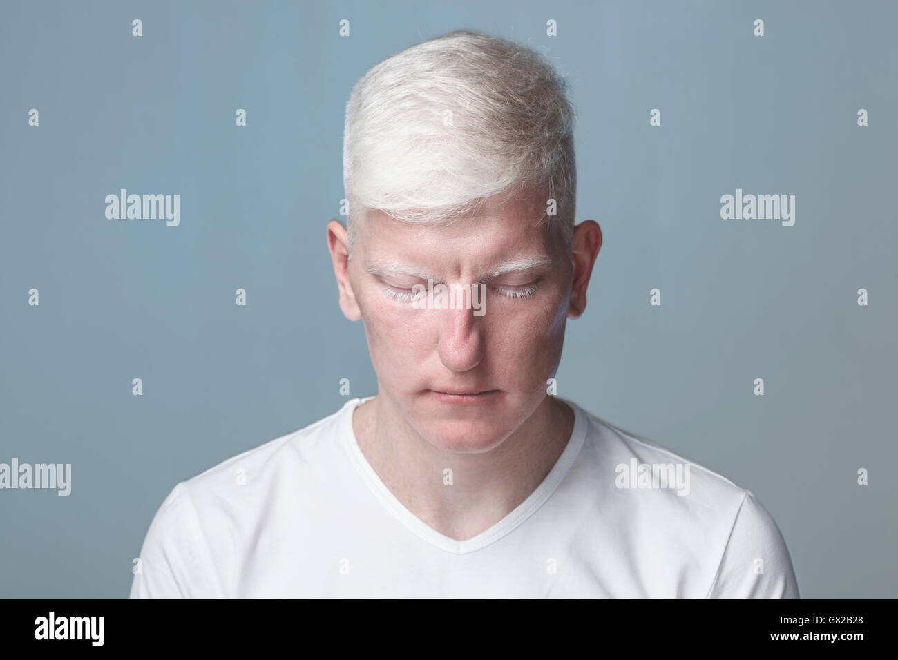 Albino-Mann mit geschlossenen Augen vor grauen Hintergrund Stockfoto