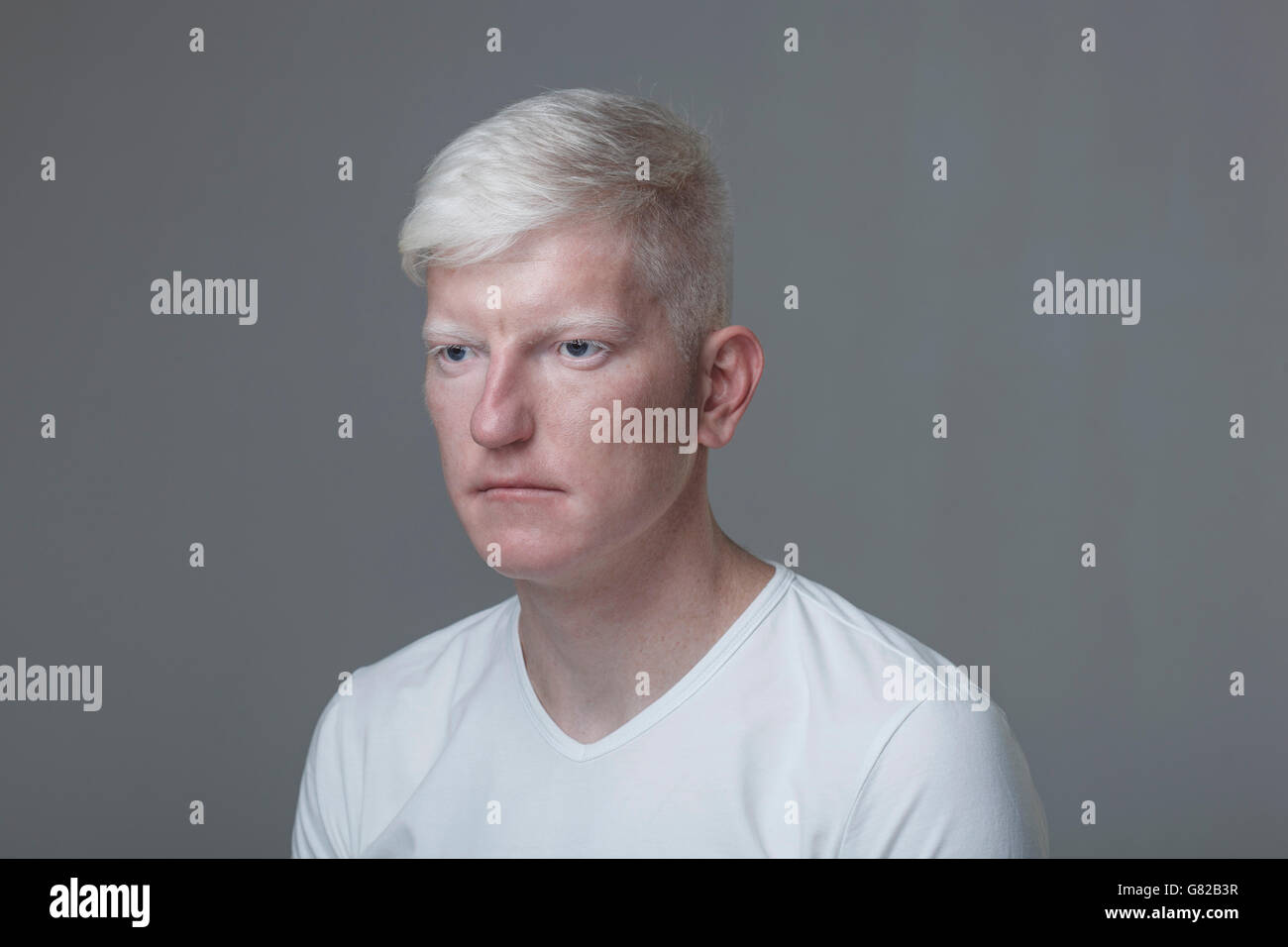 Junge Albino Menschen gegen den grauen Hintergrund Stockfoto