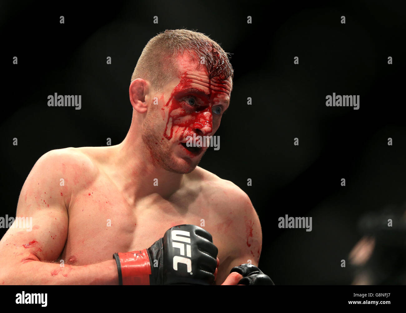 UFC Fight Night 84 - 02 Arena. Der britische Davey Grant mit einem blutgetränkten Gesicht in seinem Kampf während der UFC-Kampfnacht Stockfoto