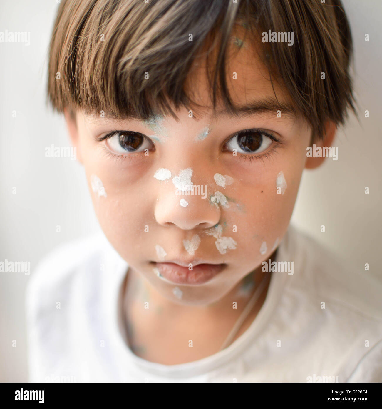 Young kid bei home Sick mit Windpocken, weiße und grüne antiseptische Creme auf den Hautausschlag Stockfoto