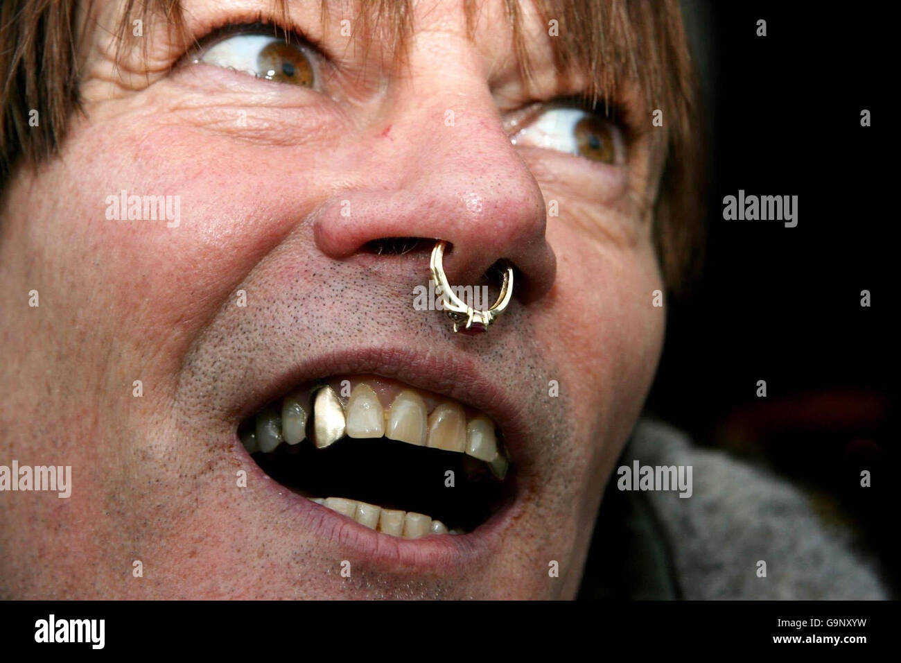 Foto. Der Künstler Robert Hawkins hat Goldzähne und einen Rubinring in der Nase in der Schlange für die Big Brother Auditions in Dublin. Stockfoto