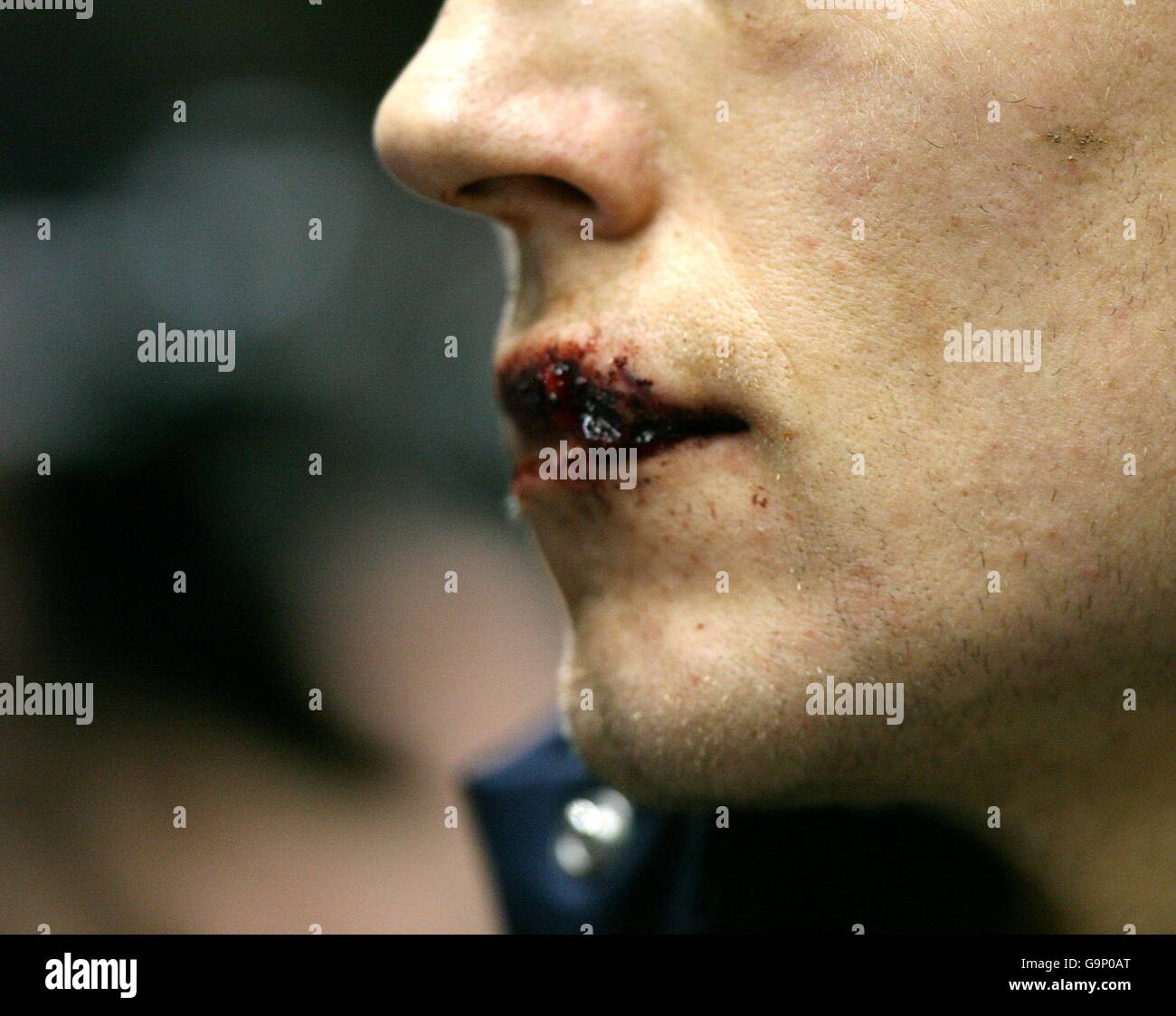 Rugby-Union - RBS 6 Nations Championship 2007 - England V Schottland - Twickenham Stockfoto