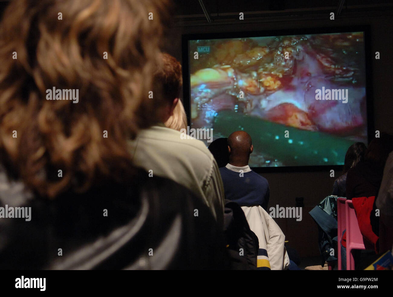 Besucher des Dana Center in London, das nur für Erwachsene zugänglich ist, sehen sich die erste Live-Übertragung von Nierentransplantationen aus dem Saint Barnabas Medical Center in New Jersey in den Vereinigten Staaten an. Stockfoto