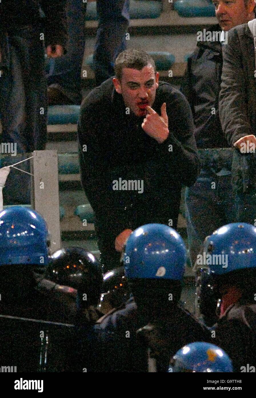 Fußball - UEFA Champions League - Viertelfinale - Erstes Bein - Roma gegen Manchester United - Olimpico Stadium. Ein Fan zeigt der Polizei das Ausmaß seiner Verletzungen. Stockfoto