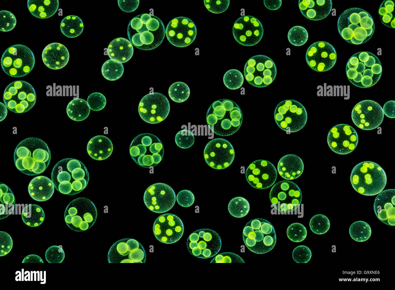 Chlorophyte oder grünen Algen (Volvox aureus) im Teich Wasser. UK. Die größeren Kugeln sind ca. 0,5 mm im Durchmesser. Digitale zusammengesetzte Bild. Stockfoto