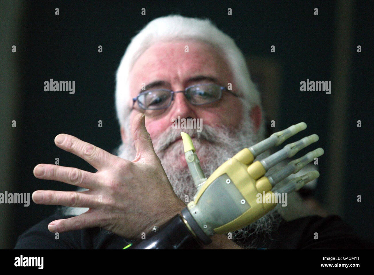 Donald McKillop mit seiner neuen Bionic Hand bei der offiziellen Eröffnung des neuen Standorts des Technologieunternehmens Touch Bionics, Livingston. Stockfoto