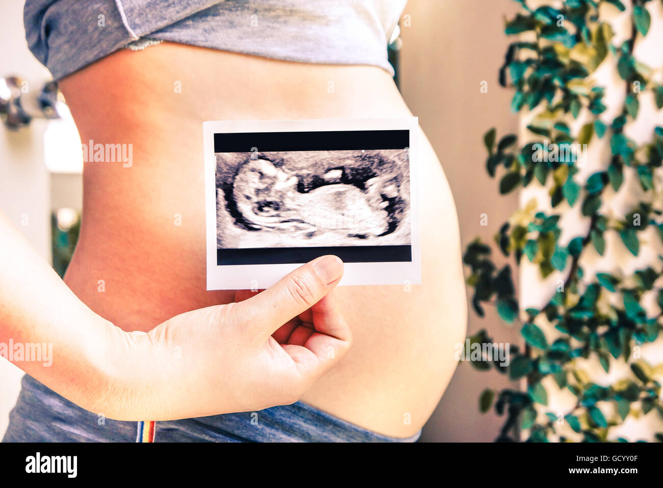 Schwangere Frau mit Ultraschall Scan Foto Stockfoto