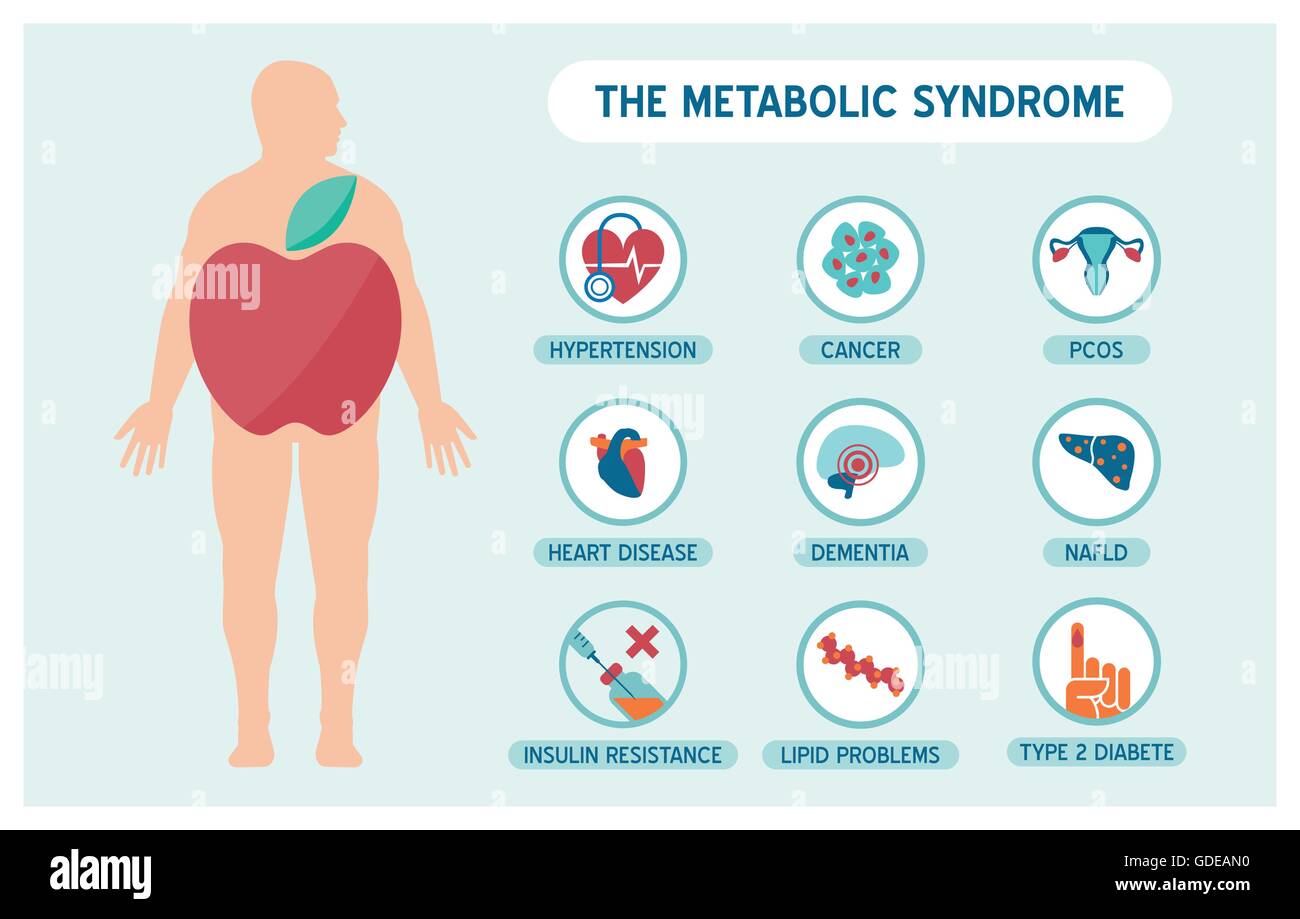 Das metabolische Syndrom Infografiken mit Krankheit medizinische Symbole, Fett männlichen Körper und Apfel-Form Stock Vektor
